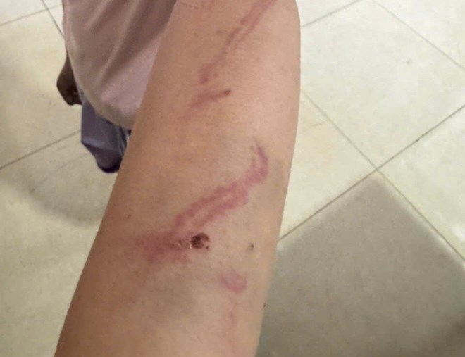 Công an vào cuộc vụ bé gái 9 tuổi ở Đắk Lắk nghi bị bạo hành