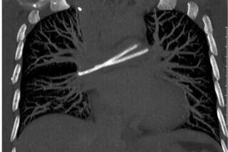 <a href="/y-te" title="Y tế" rel="dofollow">Y tế</a>