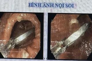 <a href="/tre-em" title="Trẻ em" rel="dofollow">Trẻ em</a>