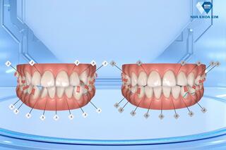 <a href="/y-te" title="Y tế" rel="dofollow">Y tế</a>