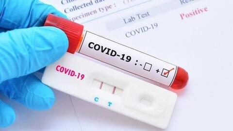 Hà Nội ghi nhận thêm 461 ca mắc COVID-19 mới
