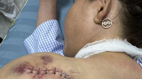 Gia Lai: Điều tra nhóm đối tượng đâm hai vợ chồng trọng thương