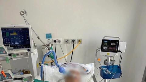 Cứu sống bệnh nhân bị súng bắn đinh bắn thủng sọ não