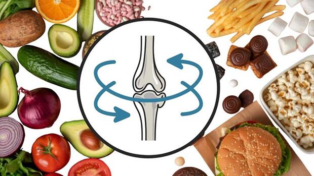 Xương khớp bị hủy hoại âm thầm bởi 4 loại thực phẩm