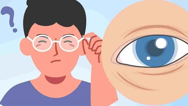 Nhìn mờ kéo dài có thể liên quan đến các bệnh lý về mắt