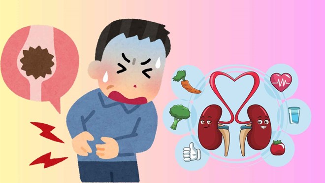 3 hiểu lầm lớn về việc chăm sóc thận