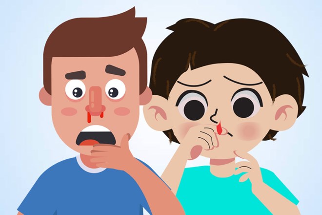 Nguyên nhân và cách xử lý chảy máu mũi thường gặp ở trẻ em