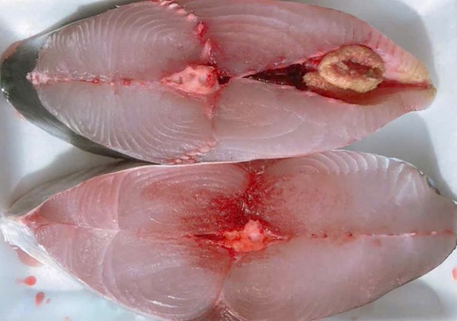 Người lao động nên ăn gì bổ sung magie để không đau cổ vai gáy