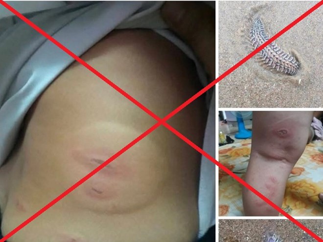 Cảnh báo thông tin bịa đặt việc cần máu hiếm cấp cứu tại Bệnh viện Đa khoa Vũng Tàu