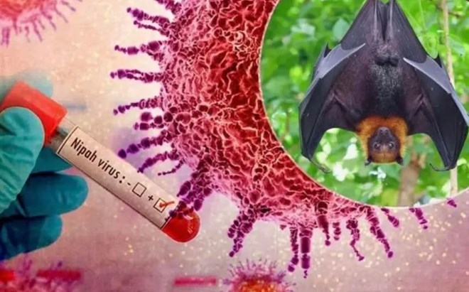 Bộ Y tế chính thức ban hành phác đồ điều trị virus Nipah
