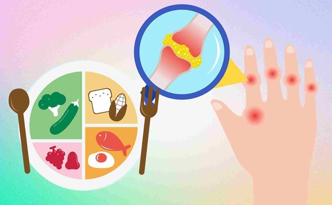 Thói quen mỗi ngày giúp kiểm soát axit uric hiệu quả
