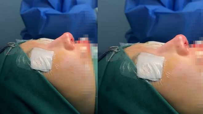 “Du lịch thẩm mỹ”, quá rủi ro khi tin vào quảng cáo trên mạng