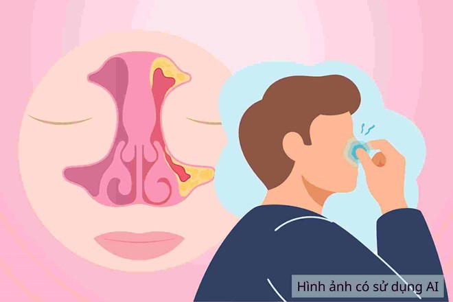 Cách phân biệt đau đầu do viêm xoang với đau nửa đầu